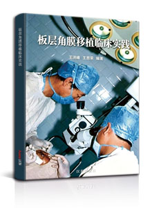 板层角膜移植临床实践